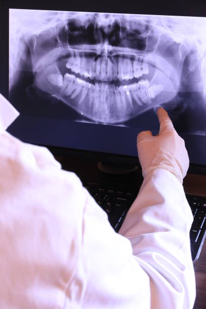 Best Emergency Dental Care for Broken or Chipped Teeth in Stevensville, MI