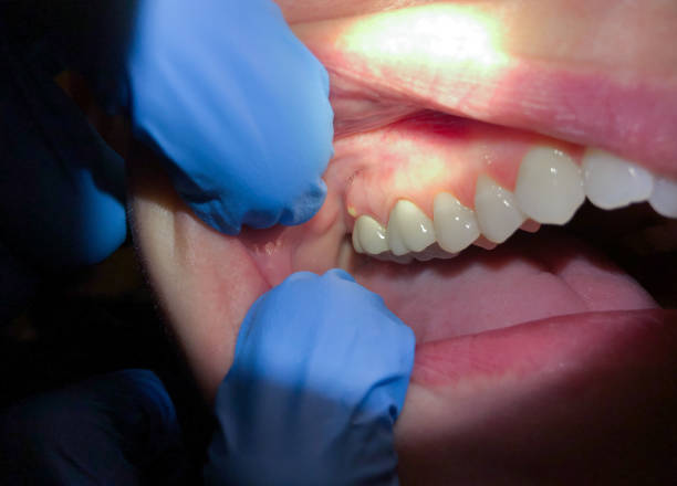 Best Pediatric Emergency Dentist in Stevensville, MI